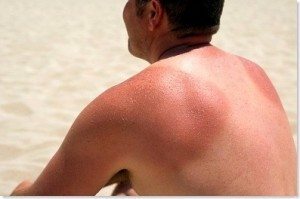 How to tan without burning your skin